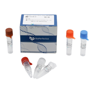 Dengue Virus Real Time PCR Kit