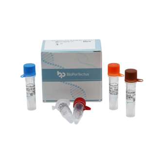 Avian Influenza Virus (H5/H7/H9) Real Time PCR Kit