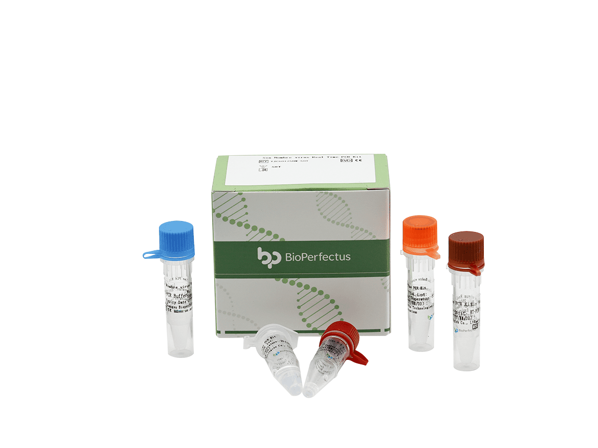 Sin Nombre Virus Real Time PCR Kit